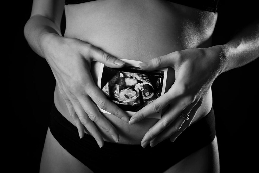 Lady holding a baby scan picture in front of her stomach for maternity photo shoot idea